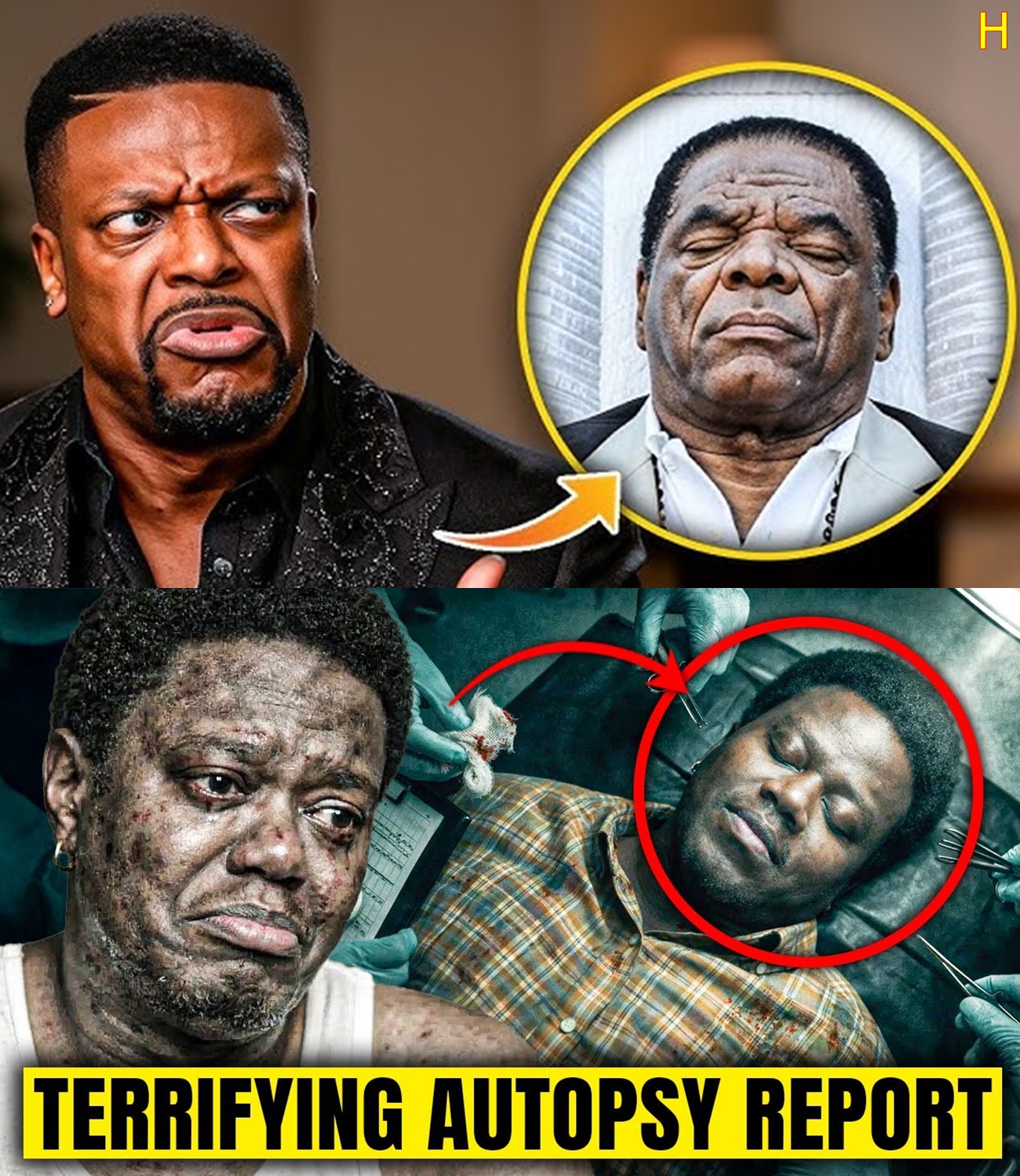 Bernie Mac’s Autopsy Reveals Horrifying Truth | What Really Happened In His Last 24 Hours.