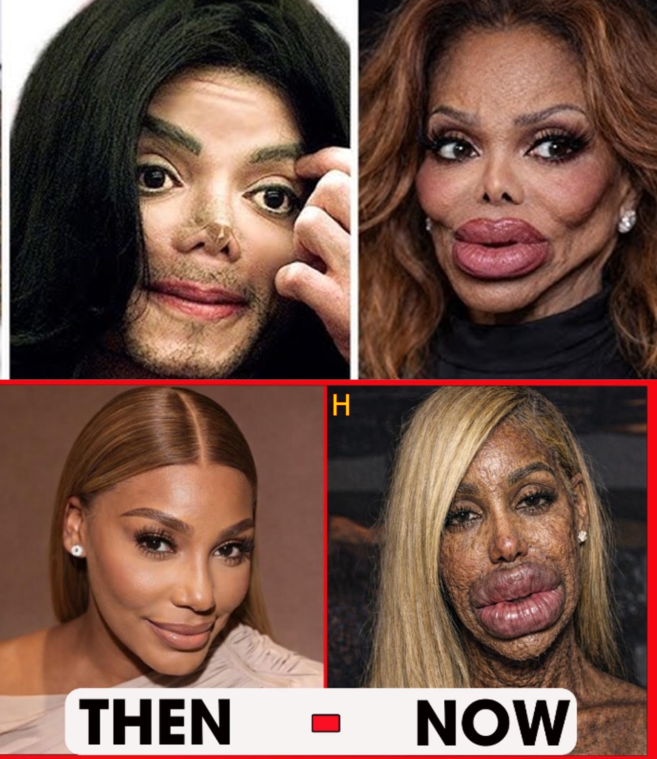 11 Black Celebrities Whose Faces and Careers Changed After Plastic Surgery | Then and Now 2026
