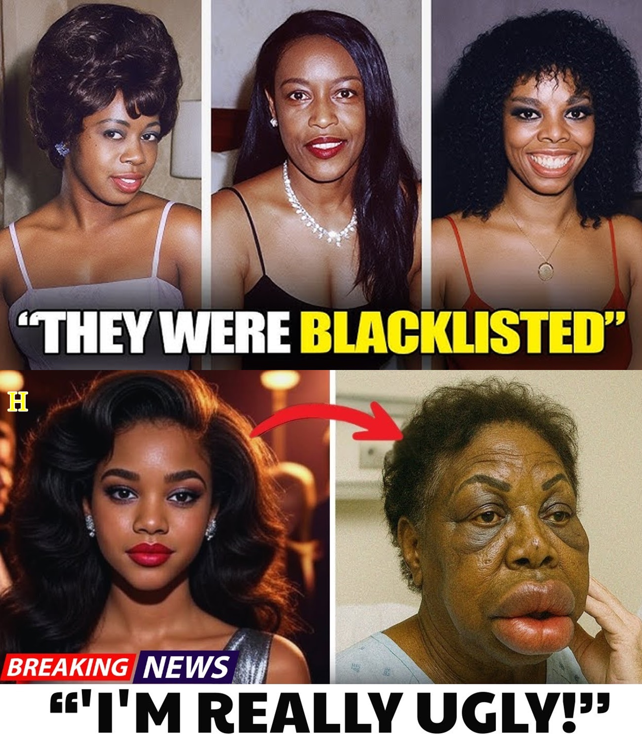 10 Black R&B Celebrities Legends Who Tragically Lost It All To Plastic Surgery