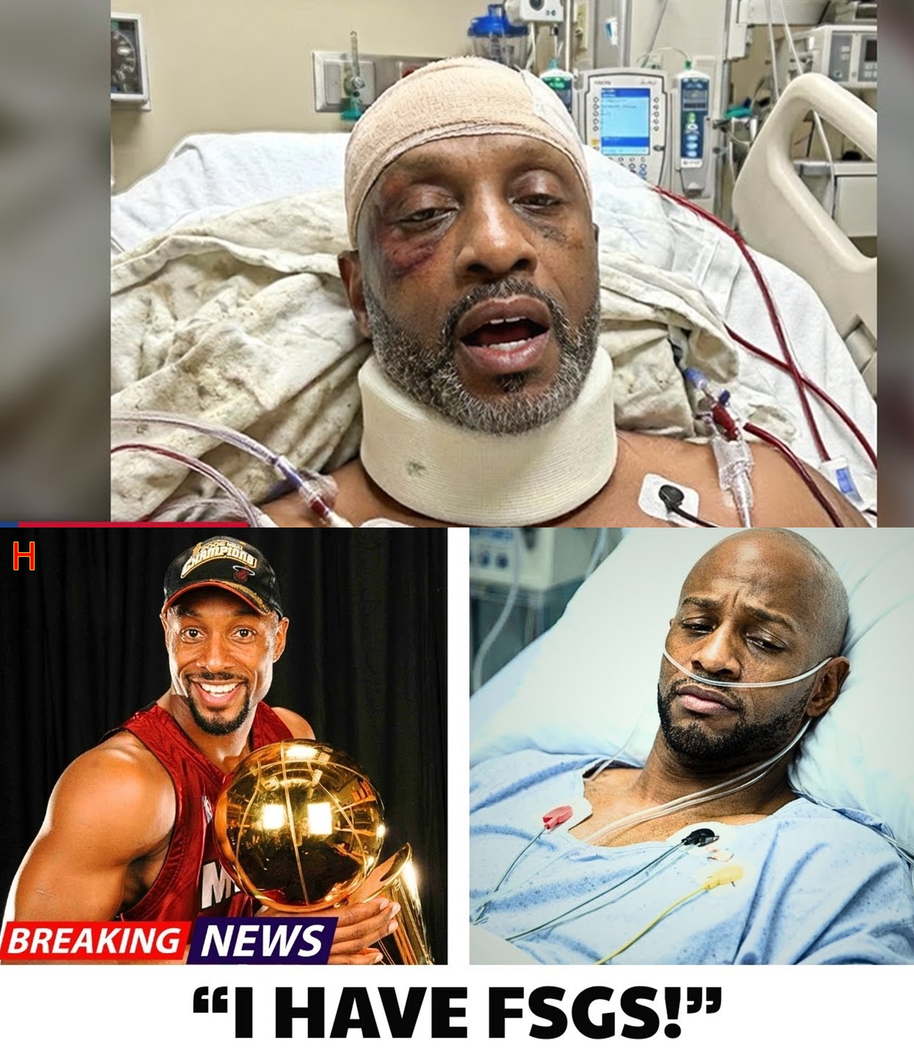 NBA Legends You Didn’t Know Had Deadly Diseases