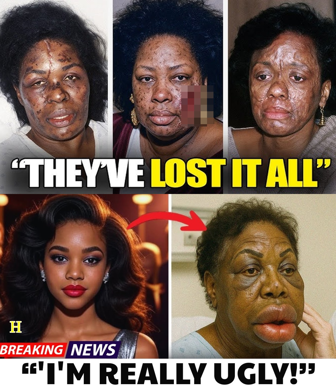 21 Black R&B Legends Who Tragically Lost It All to Plastic Surgery | Then and Now 2026