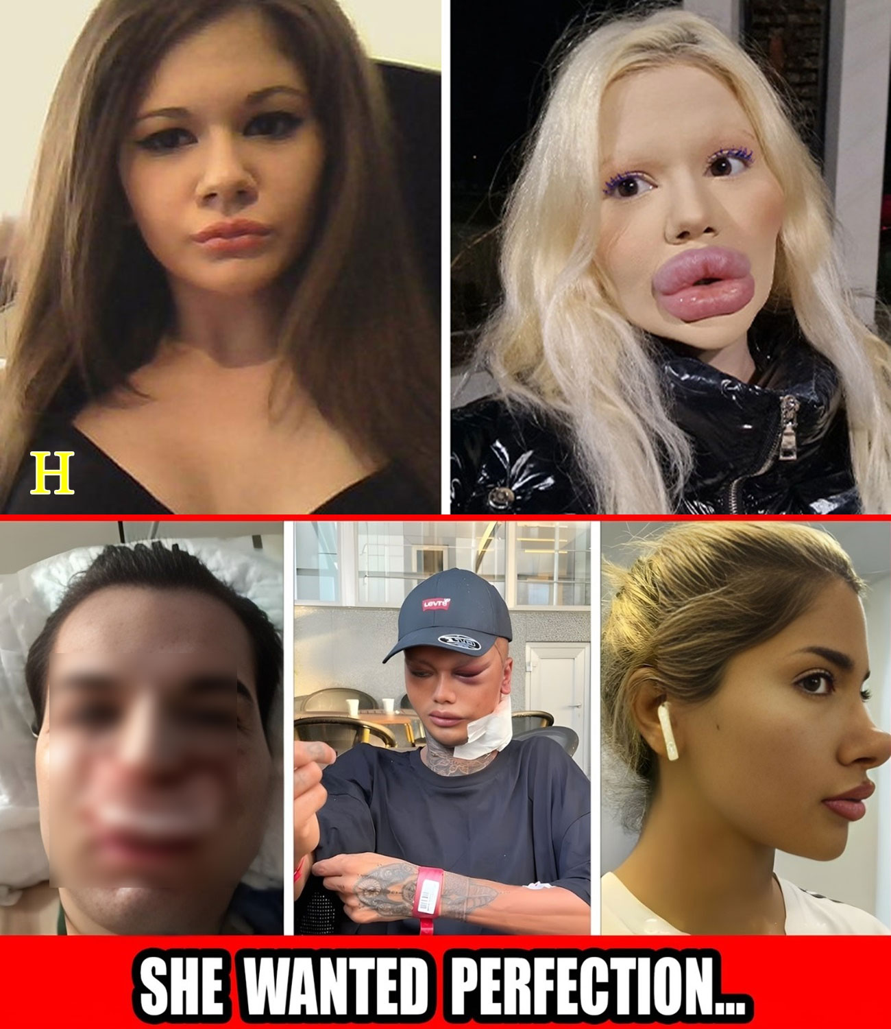 21 Plastic Surgery Fails So Extreme You Won’t Believe They’re Real!