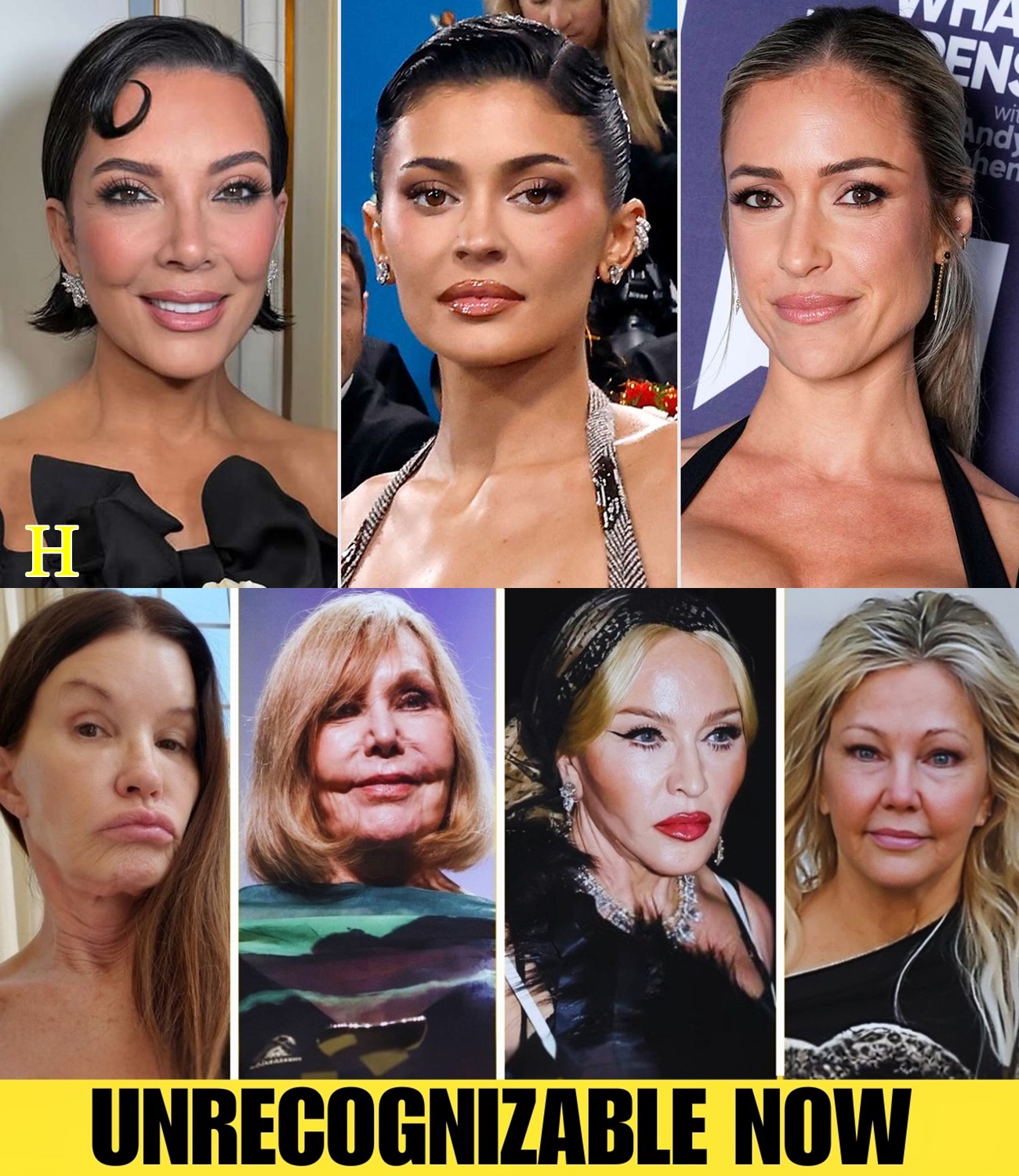 10 Celebrity Plastic Surgery Stories That Surprised Everyone | Then and Now 2026