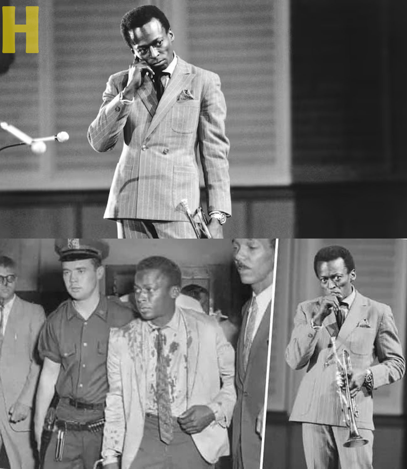 Miles Davis Truly Hated Him More Than Anyone.