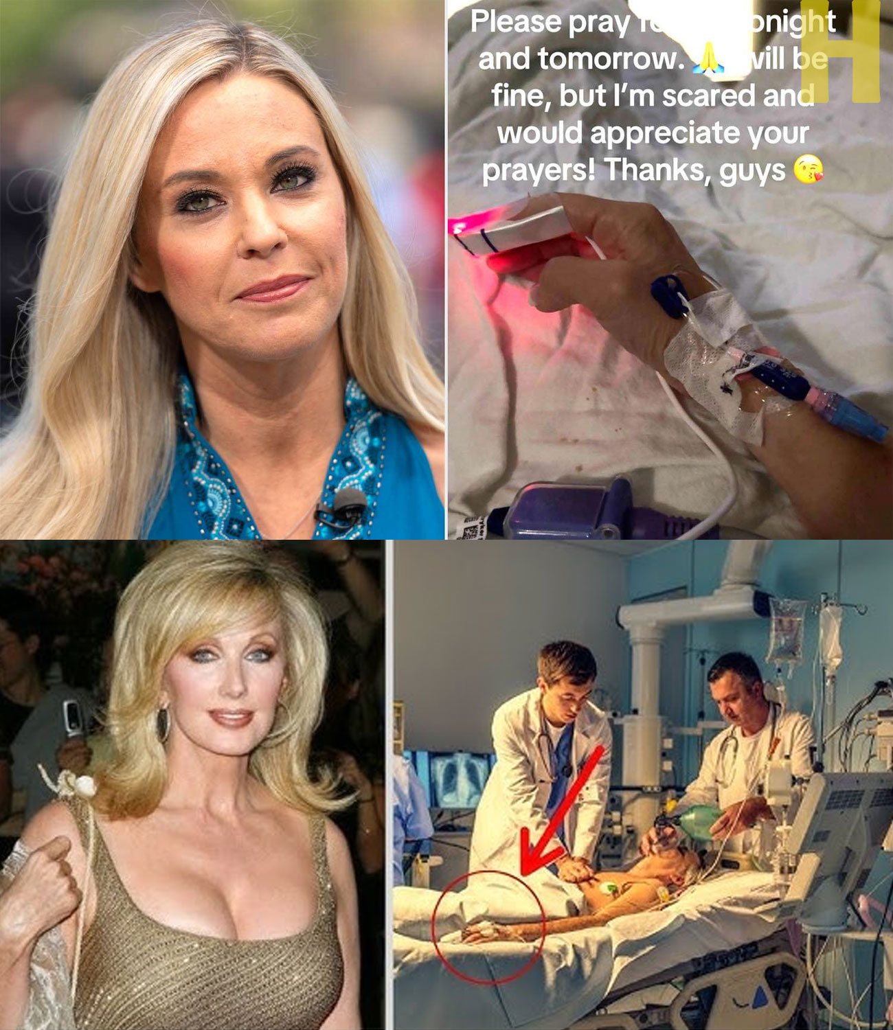 15 Famous Actors Who Died of Pancreatic Cancer | Try Not to Cry