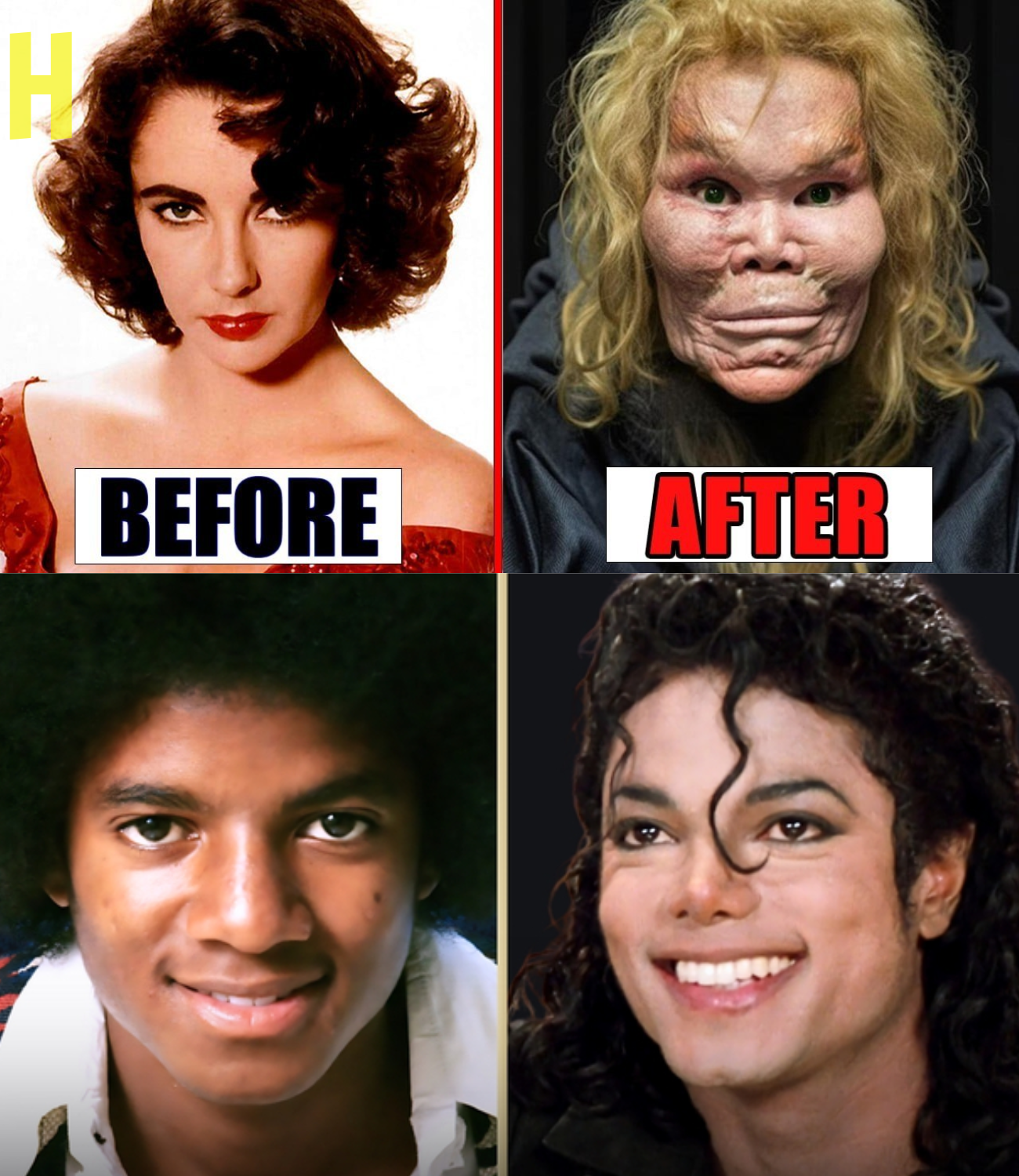 20 Golden Age Stars A Plastic Surgery Disasters