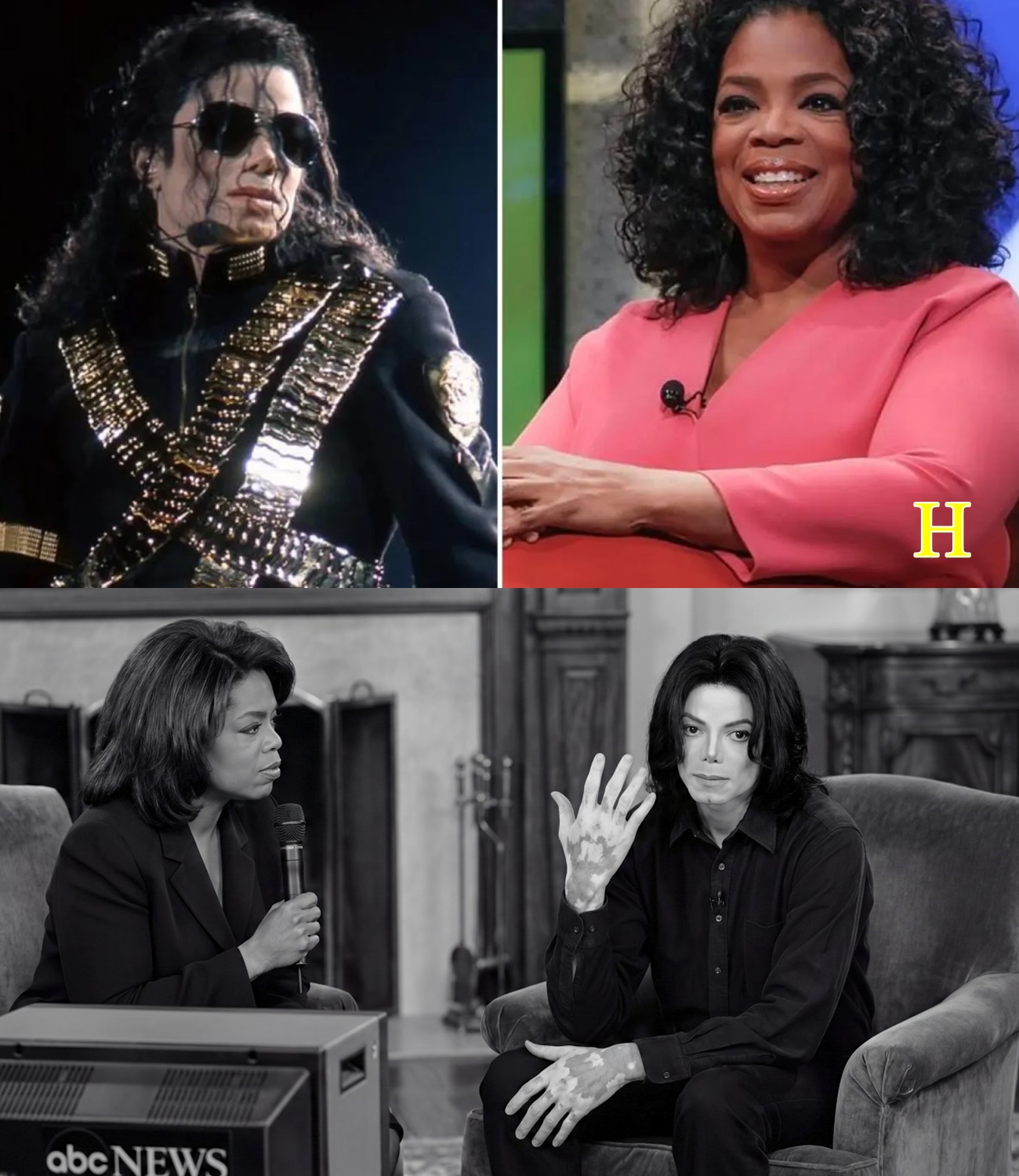 Michael Jackson Showed Oprah His Vitiligo in Live Interview —90M Viewers Were Glued to Their Screens