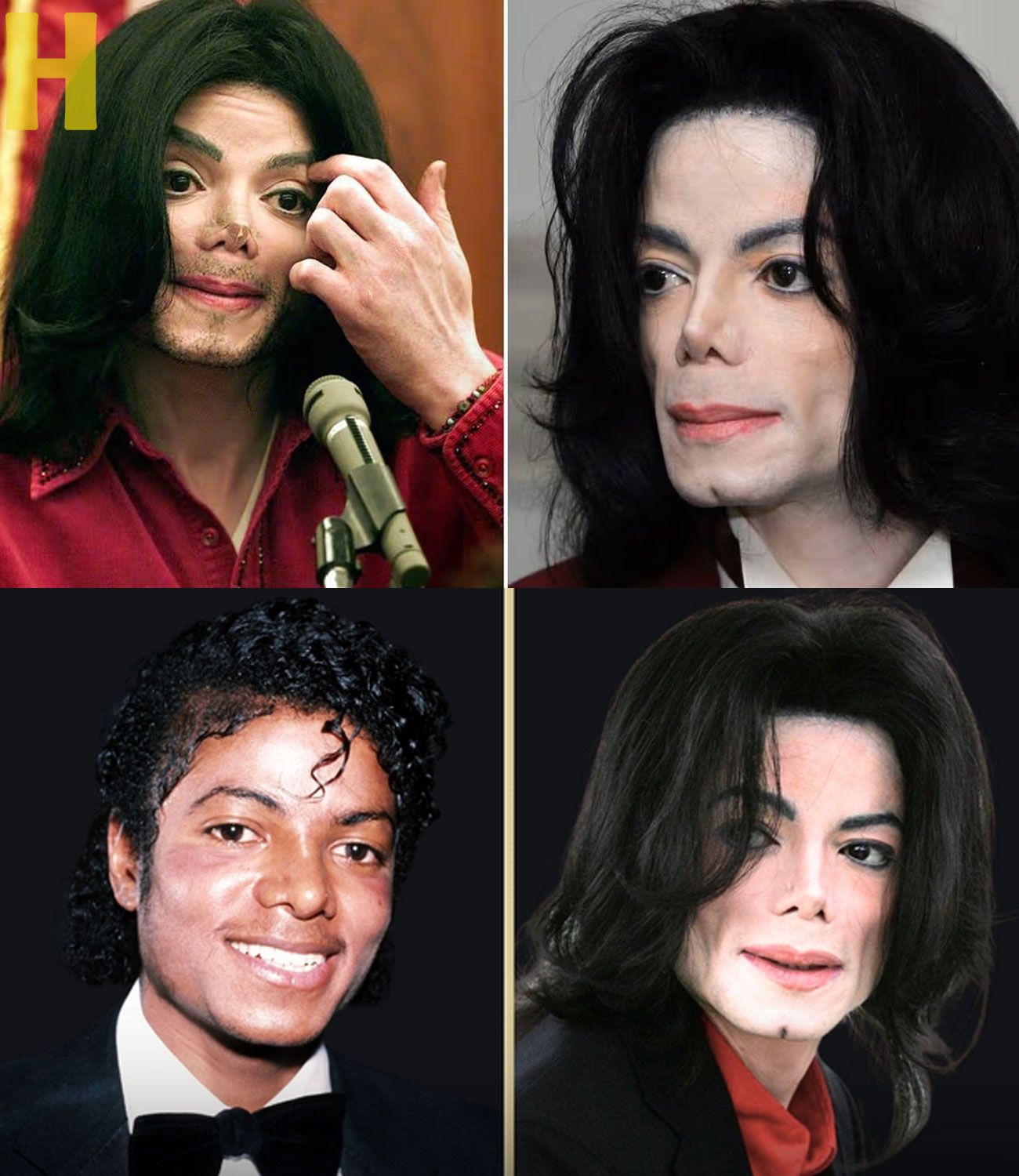How Much Plastic Surgery Did Michael Jackson Actually Have?!! NEW DETAILS | the detail.