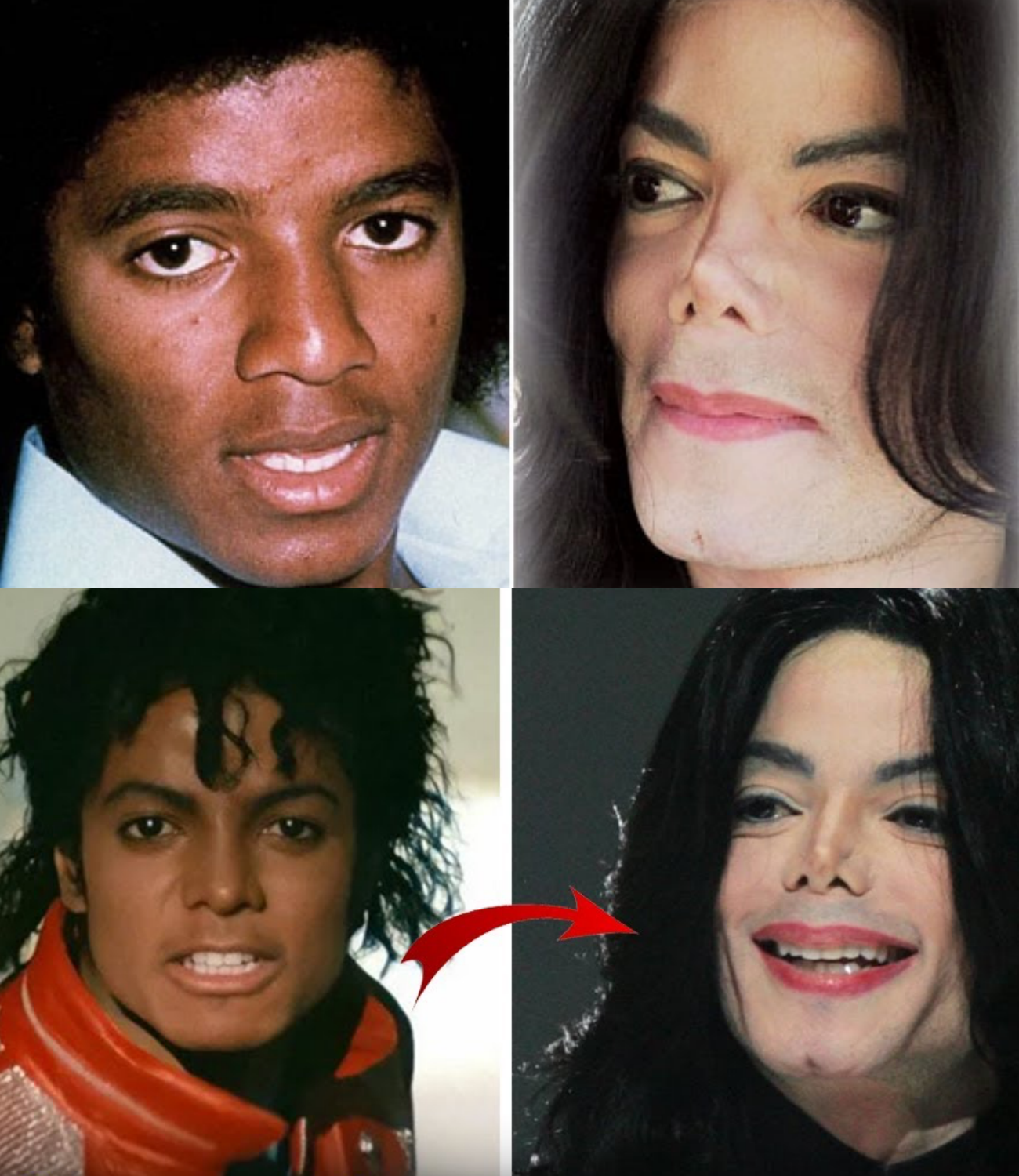 Why Did Michael Jackson’s Skin Change Color? Disease or Skin Bleaching?